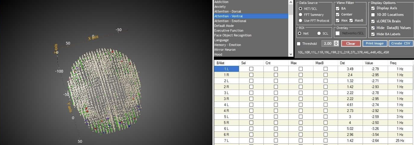 Screenshot 2025-12-11 at 3.51.13 PM concussion eeg brain map